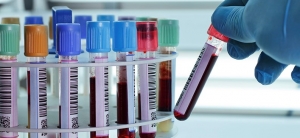 IMPORTANCIA DE LOS RESULTADOS EN EL DIAGNOSTICO MEDICO